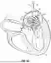 Fig. 08 - REPLACEMENT HEART VALVE SYSTEMS AND METHODS
