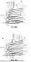 Fig. 09 - REPLACEMENT HEART VALVE SYSTEMS AND METHODS