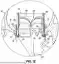 Fig. 14 - REPLACEMENT HEART VALVE SYSTEMS AND METHODS