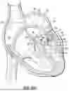 Fig. 19 - REPLACEMENT HEART VALVE SYSTEMS AND METHODS