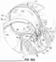 Fig. 20 - REPLACEMENT HEART VALVE SYSTEMS AND METHODS