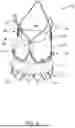 Fig. 02 - REPLACEMENT HEART VALVE IMPLANT SYSTEM
