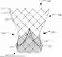 Fig. 01 - Bowed Runners and Corresponding Valve Assemblies for Paravalvular Leak Protection