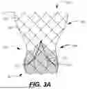 Fig. 04 - Bowed Runners and Corresponding Valve Assemblies for Paravalvular Leak Protection