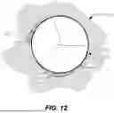 Fig. 11 - Bowed Runners and Corresponding Valve Assemblies for Paravalvular Leak Protection