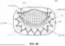 Fig. 10 - APPARATUS FOR USE IN REPAIRING MITRAL VALVES AND METHOD OF USE THEREOF