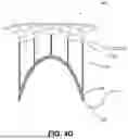 Fig. 11 - APPARATUS FOR USE IN REPAIRING MITRAL VALVES AND METHOD OF USE THEREOF