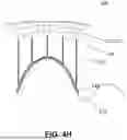 Fig. 12 - APPARATUS FOR USE IN REPAIRING MITRAL VALVES AND METHOD OF USE THEREOF