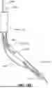 Fig. 44 - APPARATUS FOR USE IN REPAIRING MITRAL VALVES AND METHOD OF USE THEREOF