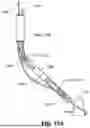 Fig. 51 - APPARATUS FOR USE IN REPAIRING MITRAL VALVES AND METHOD OF USE THEREOF
