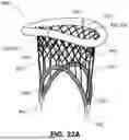 Fig. 71 - APPARATUS FOR USE IN REPAIRING MITRAL VALVES AND METHOD OF USE THEREOF