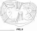 Fig. 06 - ORTHOPEDIC IMPLANTS HAVING CIRCUMFERENTIAL AND NON-CIRCUMFERENTIAL FIBERS