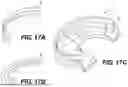 Fig. 17 - ORTHOPEDIC IMPLANTS HAVING CIRCUMFERENTIAL AND NON-CIRCUMFERENTIAL FIBERS