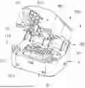 Fig. 01 - Mold with removable inserts for forming a spacer device for the replacement of a joint prosthesis