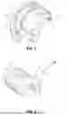 Fig. 03 - DEVICE, SYSTEM AND ACTIVATION METHOD FOR INTRAOPERATIVELY DISINFECTING BONE PROSTHESES USING BIOELECTRIC EFFECT