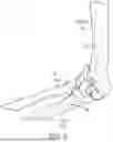 Fig. 13 - APPARATUS, SYSTEM AND METHOD FOR ASSISTING A PATH OF MOTION