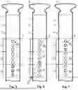 Fig. 04 - VIBRATION UNIT FOR STIMULATING AN ACUPRESSURE POINT