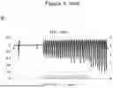 Fig. 09 - METHODS AND SYSTEMS FOR MODULATING CELLULAR ACTIVATION