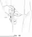 Fig. 45 - Utility Assembly and Coupling Mechanism
