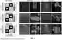 Fig. 02 - ARTIFICIAL INTELLIGENCE MODELS FOR INTERPRETATION OF POINT-OF-CARE ULTRASOUND EXAMINATIONS