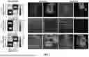 Fig. 04 - ARTIFICIAL INTELLIGENCE MODELS FOR INTERPRETATION OF POINT-OF-CARE ULTRASOUND EXAMINATIONS