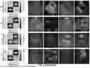 Fig. 05 - ARTIFICIAL INTELLIGENCE MODELS FOR INTERPRETATION OF POINT-OF-CARE ULTRASOUND EXAMINATIONS