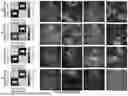 Fig. 07 - ARTIFICIAL INTELLIGENCE MODELS FOR INTERPRETATION OF POINT-OF-CARE ULTRASOUND EXAMINATIONS