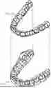 Fig. 01 - ORTHODONTIC SYSTEMS WITH VARIABLE ATTACHMENT AND WELL GEOMETRIES