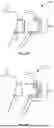 Fig. 05 - ORTHODONTIC SYSTEMS WITH VARIABLE ATTACHMENT AND WELL GEOMETRIES