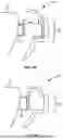 Fig. 07 - ORTHODONTIC SYSTEMS WITH VARIABLE ATTACHMENT AND WELL GEOMETRIES