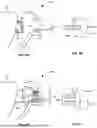 Fig. 11 - ORTHODONTIC SYSTEMS WITH VARIABLE ATTACHMENT AND WELL GEOMETRIES