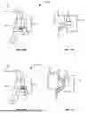 Fig. 12 - ORTHODONTIC SYSTEMS WITH VARIABLE ATTACHMENT AND WELL GEOMETRIES