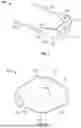 Fig. 02 - MENTUM SECUREMENT DEVICE AND METHOD OF USING THE SAME