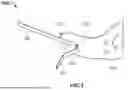 Fig. 03 - MENTUM SECUREMENT DEVICE AND METHOD OF USING THE SAME