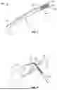 Fig. 07 - MENTUM SECUREMENT DEVICE AND METHOD OF USING THE SAME