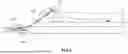 Fig. 08 - MENTUM SECUREMENT DEVICE AND METHOD OF USING THE SAME