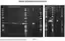 Fig. 06 - GENE-BASED MEDICINES AND CELLULAR THERAPY FOR DISEASE