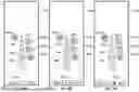 Fig. 22 - METHOD FOR ROBOTICALLY CONTROLLING INTERVENTIONAL DEVICE ASSEMBLY