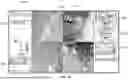 Fig. 35 - METHOD FOR ROBOTICALLY CONTROLLING INTERVENTIONAL DEVICE ASSEMBLY
