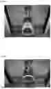 Fig. 07 - CYLINDRICAL HEALTH DEVICE AND METHOD FOR MANUFACTURING CYLINDRICAL HEALTH DEVICE