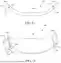 Fig. 08 - ADJUSTABLE-SIZE BACKBOARD FOR A MECHANICAL CPR DEVICE