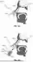 Fig. 03 - NASAL CAVITY SAMPLING METHODS AND APPARATUS