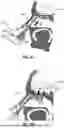 Fig. 04 - NASAL CAVITY SAMPLING METHODS AND APPARATUS