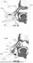 Fig. 05 - NASAL CAVITY SAMPLING METHODS AND APPARATUS