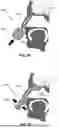 Fig. 06 - NASAL CAVITY SAMPLING METHODS AND APPARATUS