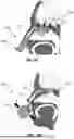 Fig. 07 - NASAL CAVITY SAMPLING METHODS AND APPARATUS