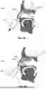 Fig. 10 - NASAL CAVITY SAMPLING METHODS AND APPARATUS