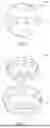 Fig. 04 - Multi-Layered and/or Non-Uniform Weight Distributed Pickleball Ball