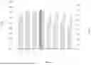 Fig. 07 - ITERATIVE SPECULARITY FACTORIZATION FOR IMAGE ENHANCEMENT