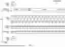 Fig. 04 - DECODE VARIABLE LENGTH RANGES